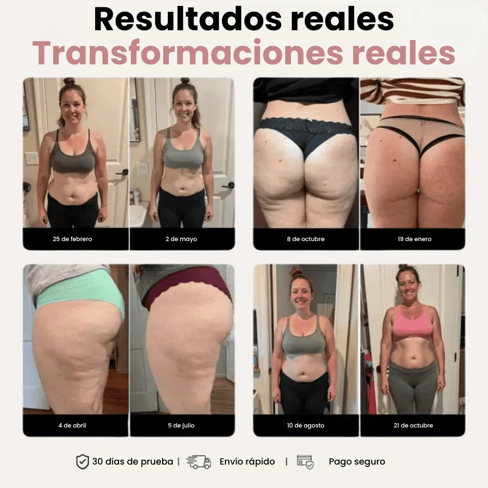 Legging 3D Celluout™ – Redefine tu silueta sin esfuerzo