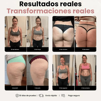Legging 3D Celluout™ – Redefine tu silueta sin esfuerzo